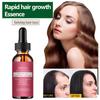 5% Миноксидил Биотин Сыворотка для волос для мужчин и женщин Густая сыворотка для волос Здоровые волосы Проникает от корней до кончиков