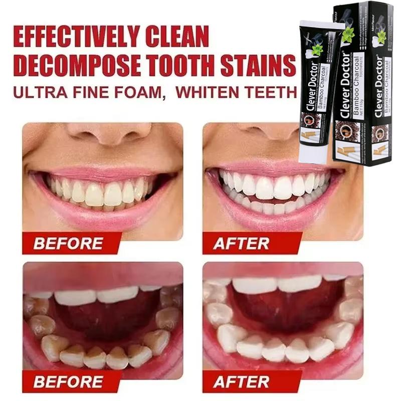 Быстрое удаление пятен Зубная паста Удаление налета Пятна Гигиена полости рта Чистка Свежее дыхание Отбеливание зубов Инструменты Уход за здоровьем полости рта