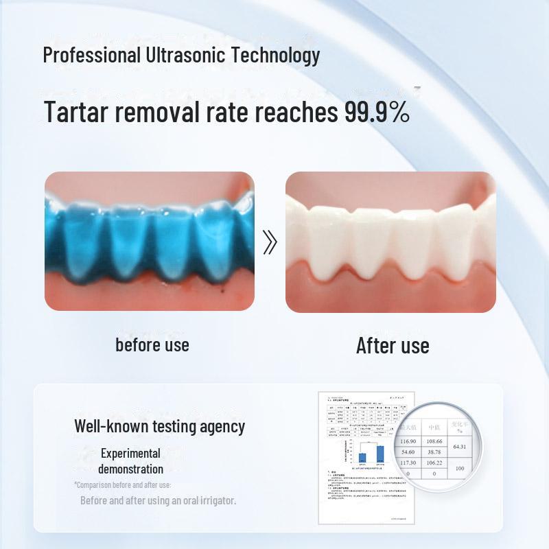 Yaxi Yasiv8P Портативный ультразвуковой ирригатор для глубокой очистки