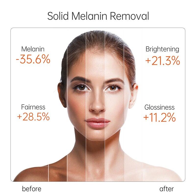 JoyPretty 15 мл антиоксидантная сыворотка для лица с витамином С, отбеливающая, осветляющая, увлажняющая, для лица, для удаления темных пятен, для красоты лица, для ухода за кожей с гиалуроновой кислотой