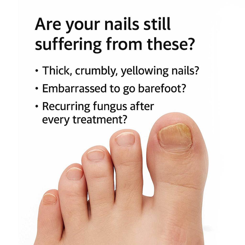 Ручка для ногтей на ногах Трещина ногтя, Раствор для ухода за вросшим ногтем, Мягкий ноготь, Серая ручка 4 мл