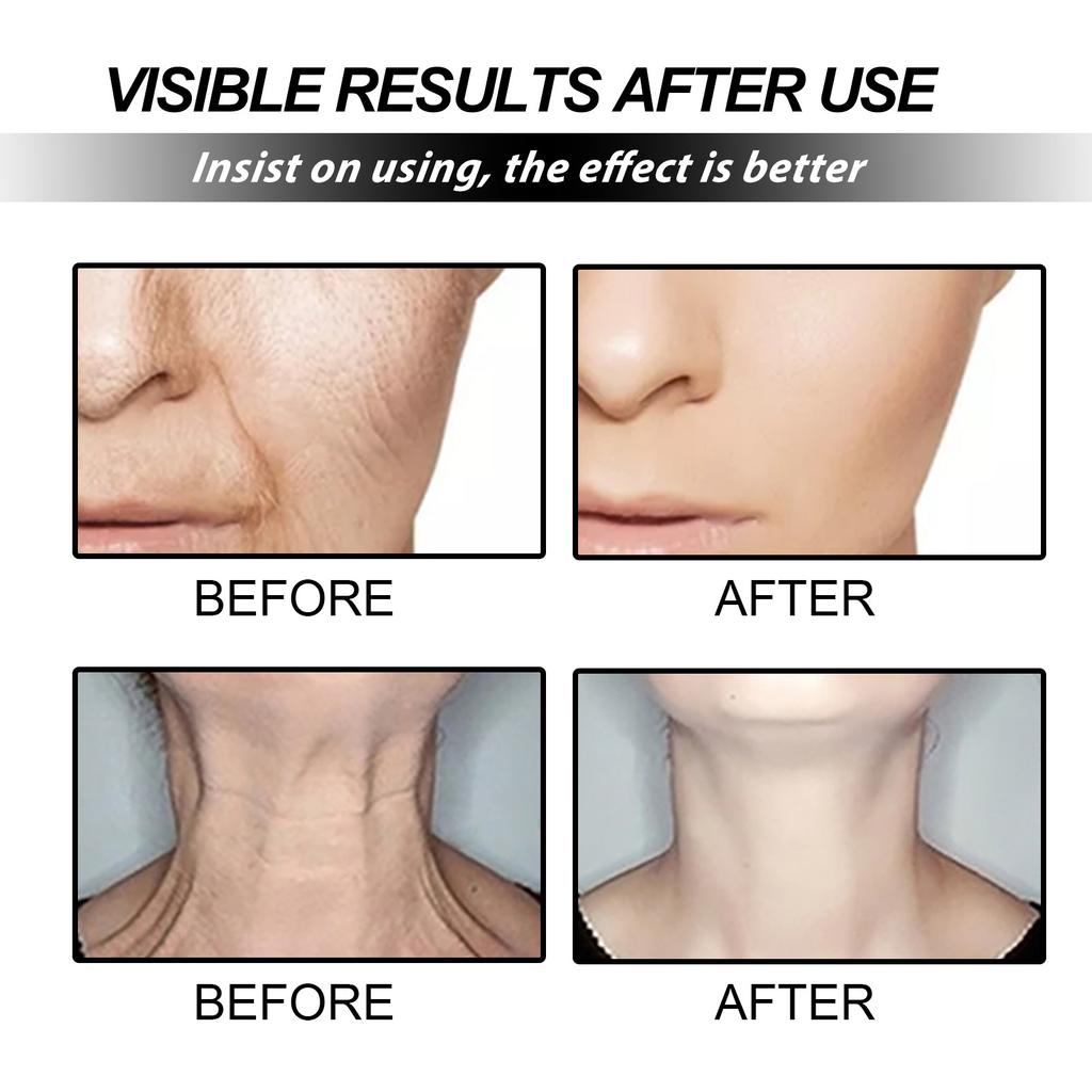 EELHOE Крем для лица против морщин, уход за кожей, против старения, укрепляющая косметика, гиалуроновая кислота, увлажняющие, отбеливающие косметические товары