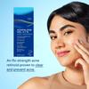 Acne Gel Acne Moisturizing Gel Is Suitable For Sensitive Skin And Gentle Skin Care45g