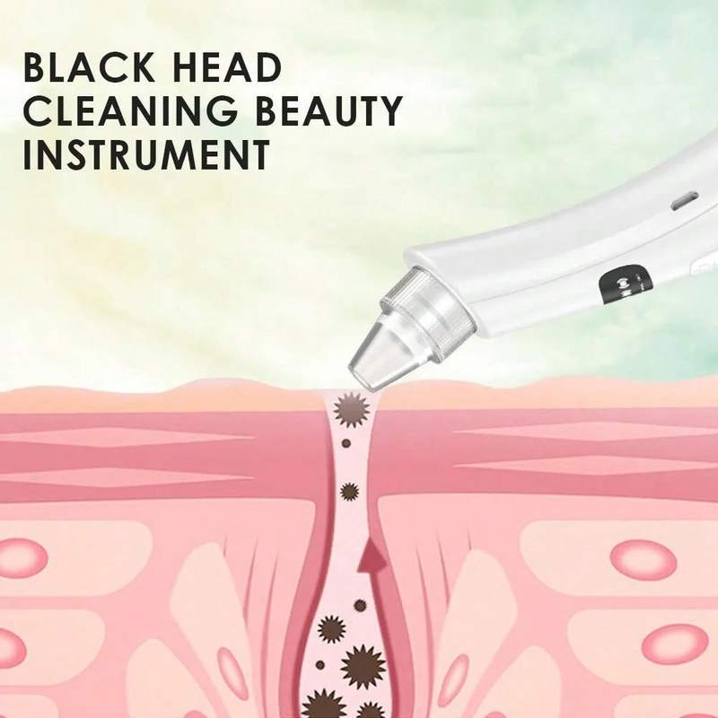 Visual Pore Cleaner Electric Blackhead Remover Device with 5 Suction Levels Deep Cleansing Facial Vacuum for Blackheads and Acne