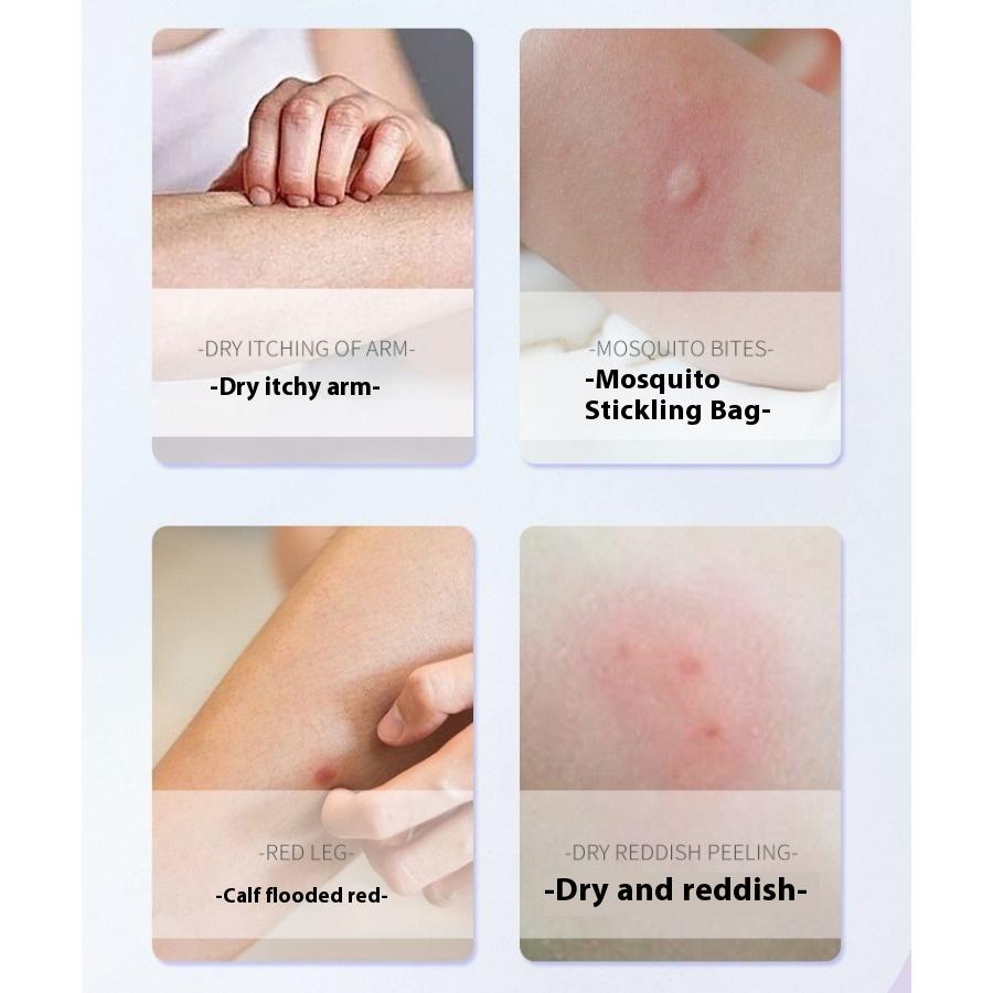 Прохладный и освежающий успокаивающий крем-карандаш против зуда от укусов комаров с окопником Крем Xiaobao успокаивающий противозудный репеллент от комаров