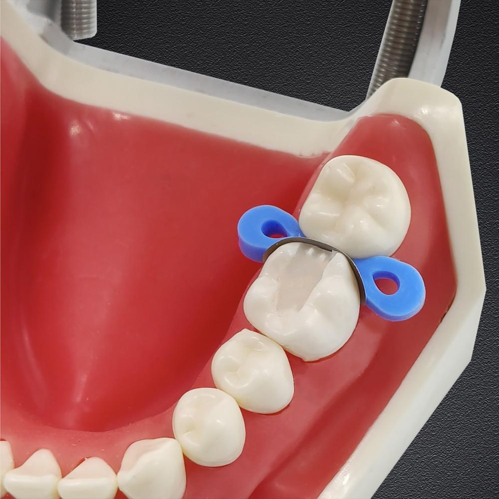 20 шт./60 шт./120 шт. Стоматологическая матрица Секционные контурные матрицы Матричное кольцо Tofflemire Stuck Стоматологический лабораторный материал S/M/L