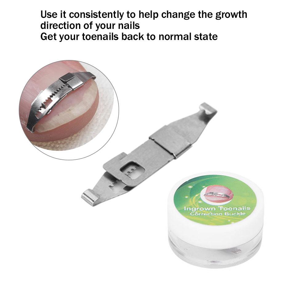 Инструмент для коррекции ногтей, 3 шт./компл., корректор вросшего ногтя, пряжка для корректора ногтей