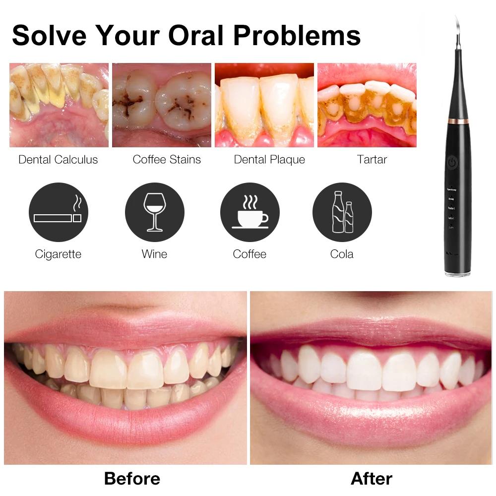 Средство для удаления зубного камня, скалер, очиститель зубов, электрический очиститель для удаления зубного налета и пятен, отбеливание зубов, 3 головки, гигиена полости рта