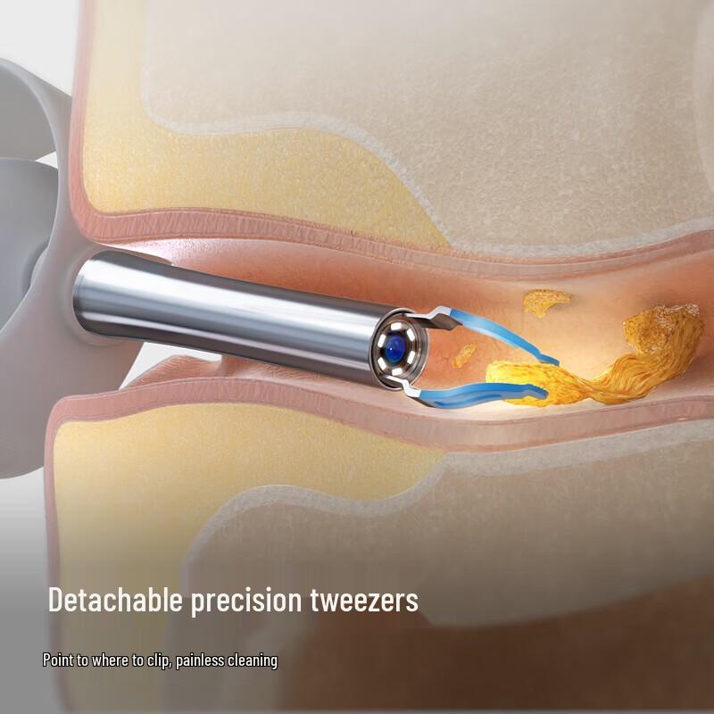 Bebird Visual Ear Pick with Removable Precision Tweezers and Storage Box