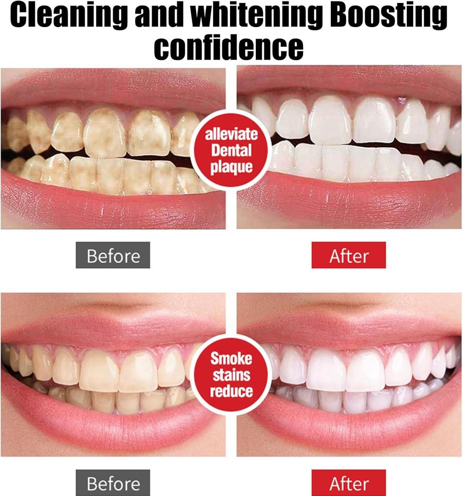 Зубная паста Sp7 Probiotic Toothpaste Whitening, зубная паста Sp-7 Ultra Whitening, зубная паста Sp 7, зубная паста для удаления пятен и отбеливания, глубокая очистка