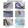 HD Digital Skin Analyzer Professional Hair Scalp Camera Detector Hair Follicle Oil Moisture Test Device 15inch