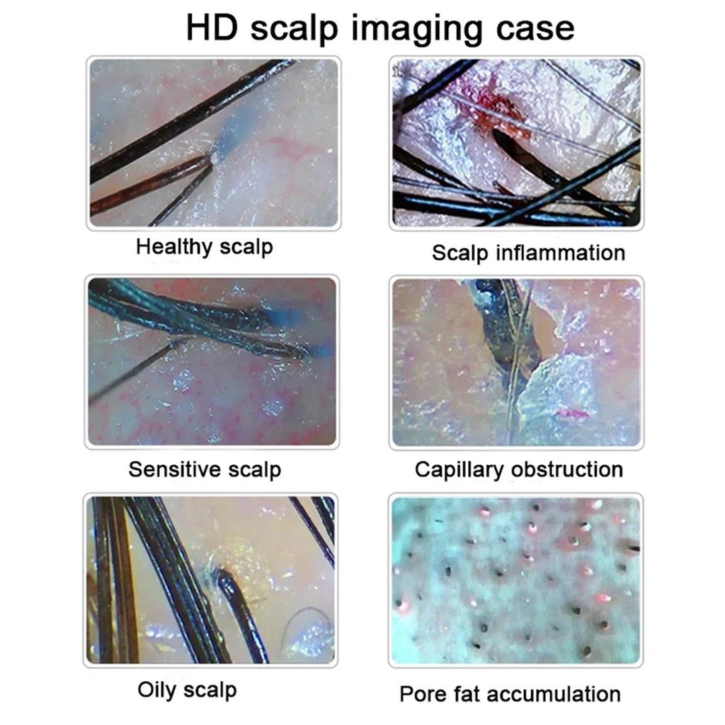 HD Digital Skin Analyzer Professional Hair Scalp Camera Detector Hair Follicle Oil Moisture Test Device 15inch
