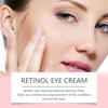 Falten Augen Retinol Augen Creme Eye Roller Ball Creme Für Augenringe Verblasst Feine Linien Entfernen Augen Taschen 20г