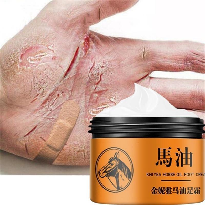 Крем для восстановления рук и ног с лошадиным маслом. Крем для ухода за ногами. Крем для ухода за бери-бери и зудом на ногах.