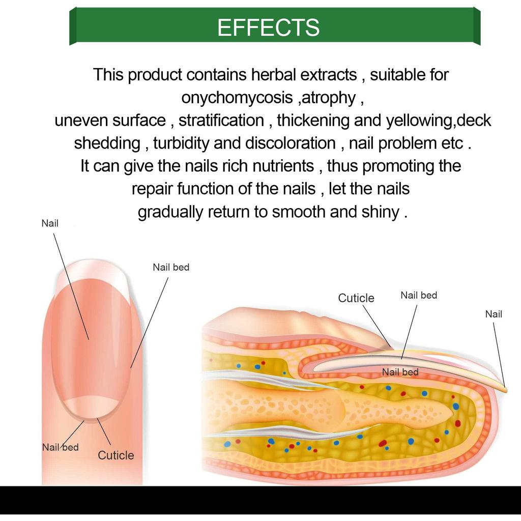 50 мл раствор для восстановления ногтей, раствор для ухода за ногтями рук и ног для восстановления и увлажнения, серых, блестящих и мягких ногтей