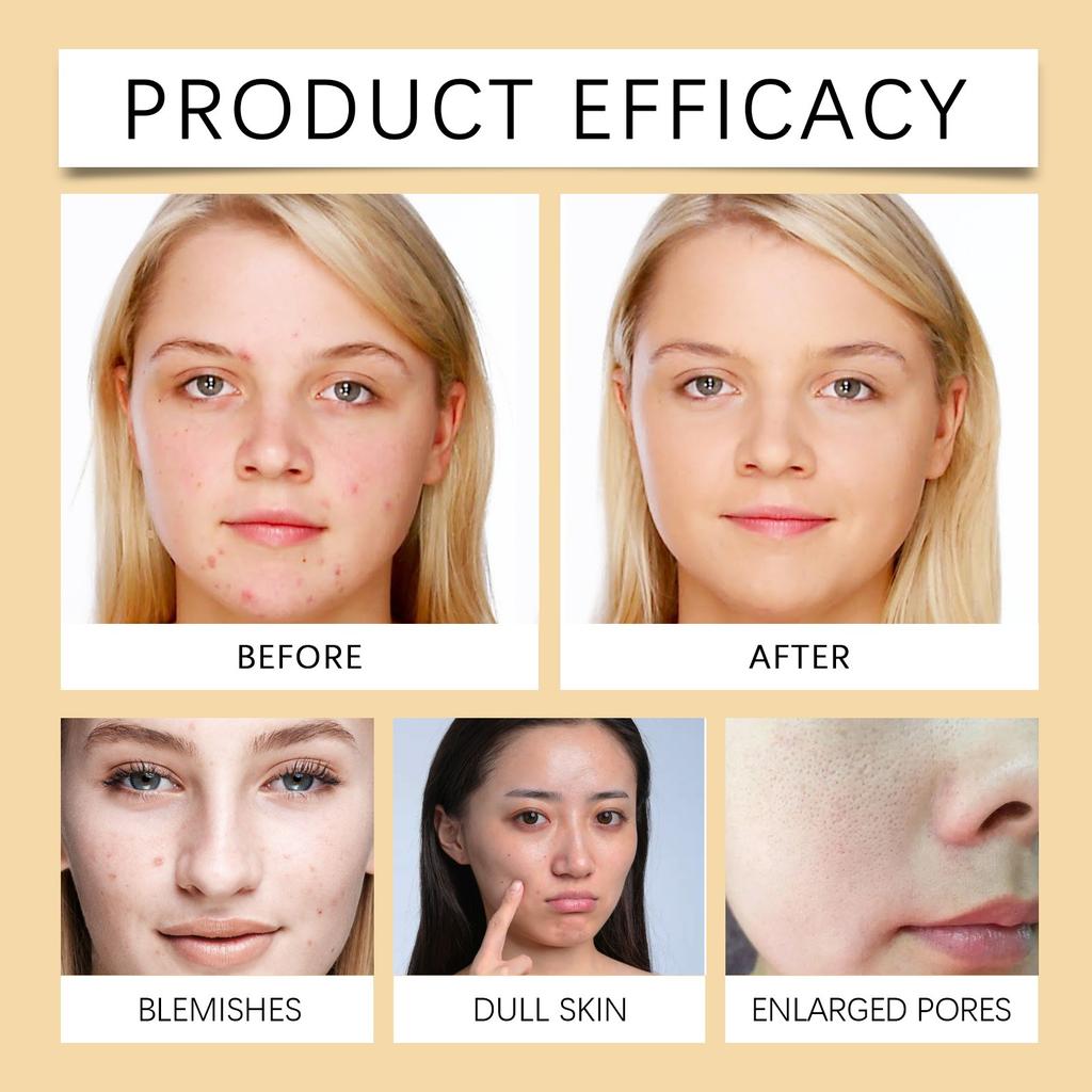 VitaminC Foaming Cleanser Gently Cleanses Pores  Acne Cleanses The Face And Moisturizes100ml