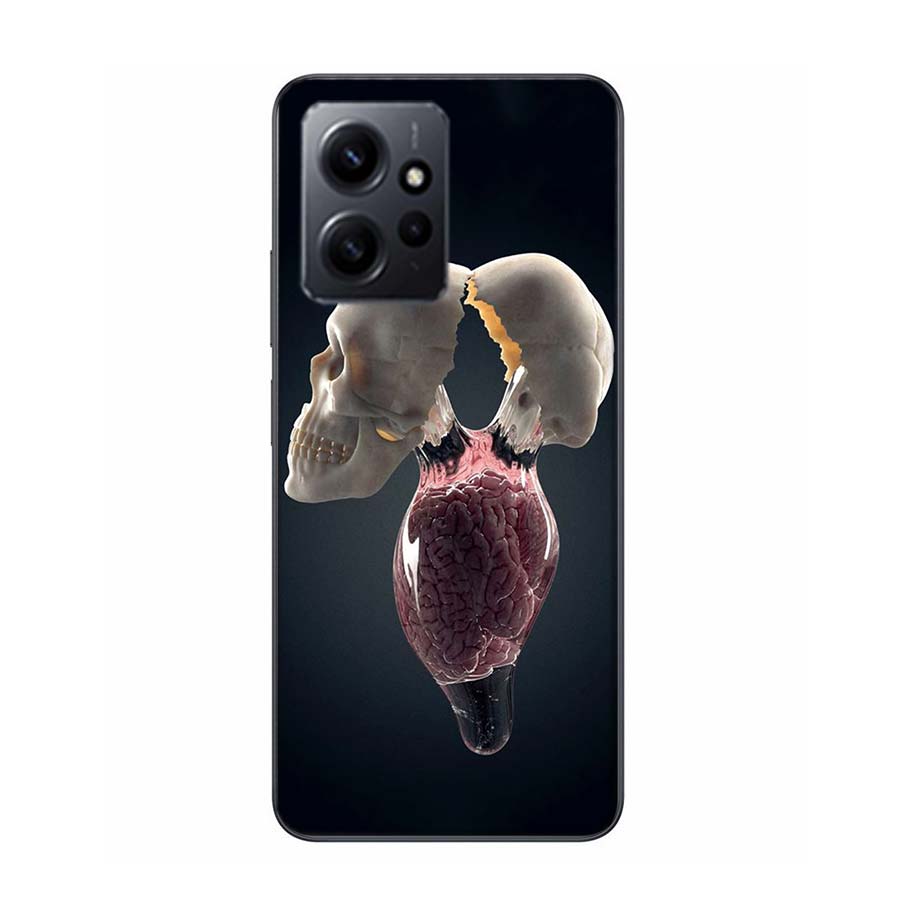 The Cerebral Cortex And Key Components Phone Case For Redmi 12 13C 12C 15C 9 10 10C Note 13 Pro Plus 14 15 Pro 9T 9C 9A TPU Soft