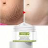 Say Goodbye To Stretch Marks with Our Powerful Fade Cream