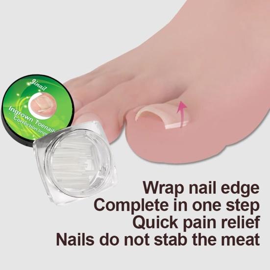 Yousheng 10/20/30/50 шт. Накладка для ногтей Простая в использовании Многофункциональная Легкая Накладка для заполнения вросшего ногтя для дома