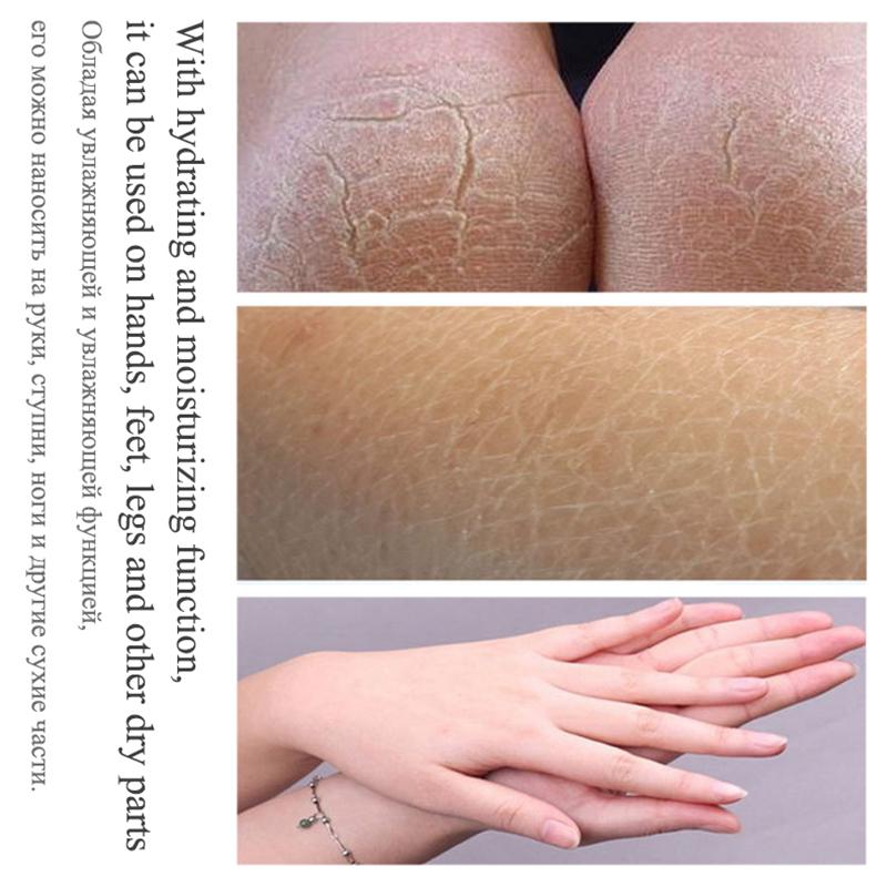 Крем для ног против высыхания трещин, крем для восстановления пяток, трещин, удаление омертвевшей кожи, уход за руками, ногами, уход за кожей рук и ног