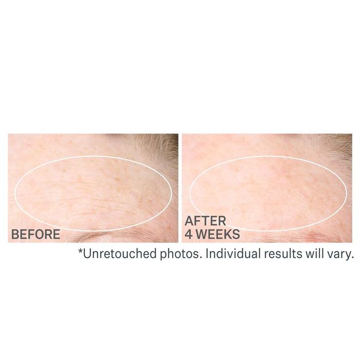 Strivectin Sd Advanced Plus Krem Na Zmarszczki I Rozstępy 60 Ml