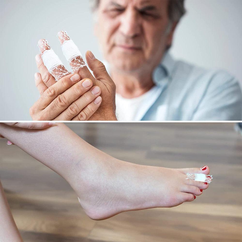 1 рулон сетчатый трубчатый бинт эластичная сетка повязка для ран трубка марля дышащий бинт фиксационная сетка для запястья локтя голени