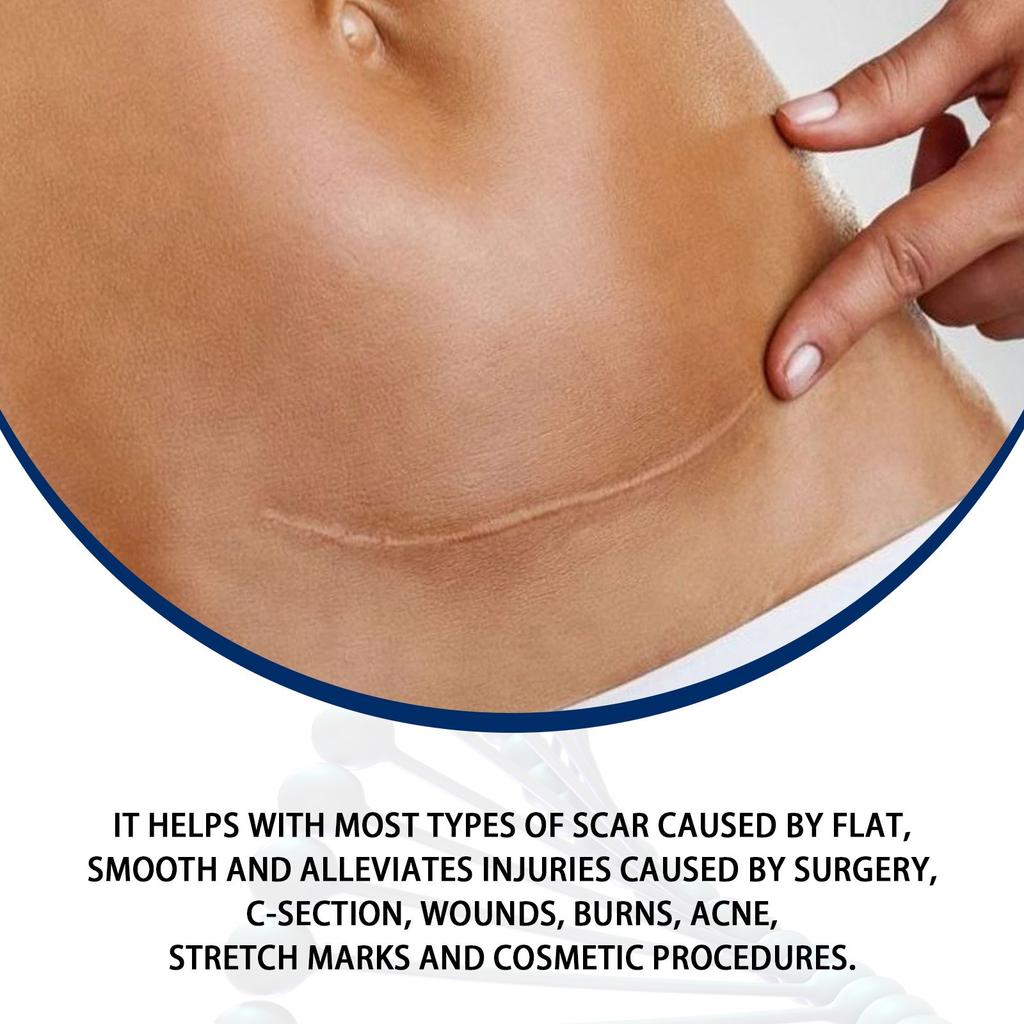 Гель от шрамов, удаление пятен от прыщей, растяжек, ожогов, уменьшает появление старых и новых