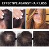 Hair Density