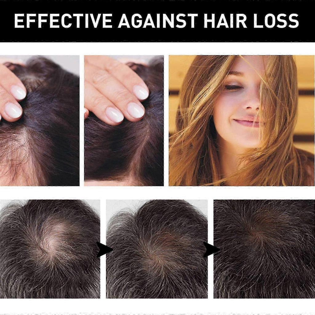 Hair Density