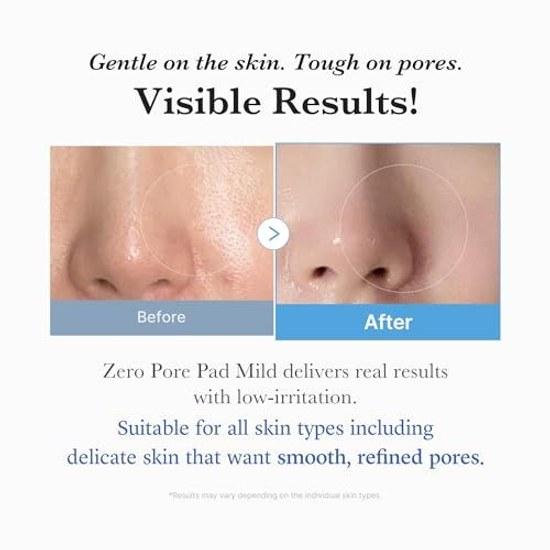 Medikube Zero Pore Pads 2.0 Mild (70 Pads) Toner Wiping
