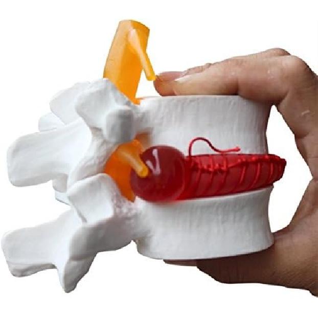 BoNew-Oral 1:1.5 Anatomical Human Lumbar Vertebrae Degenerative Lumbar Human Spine Model White Color