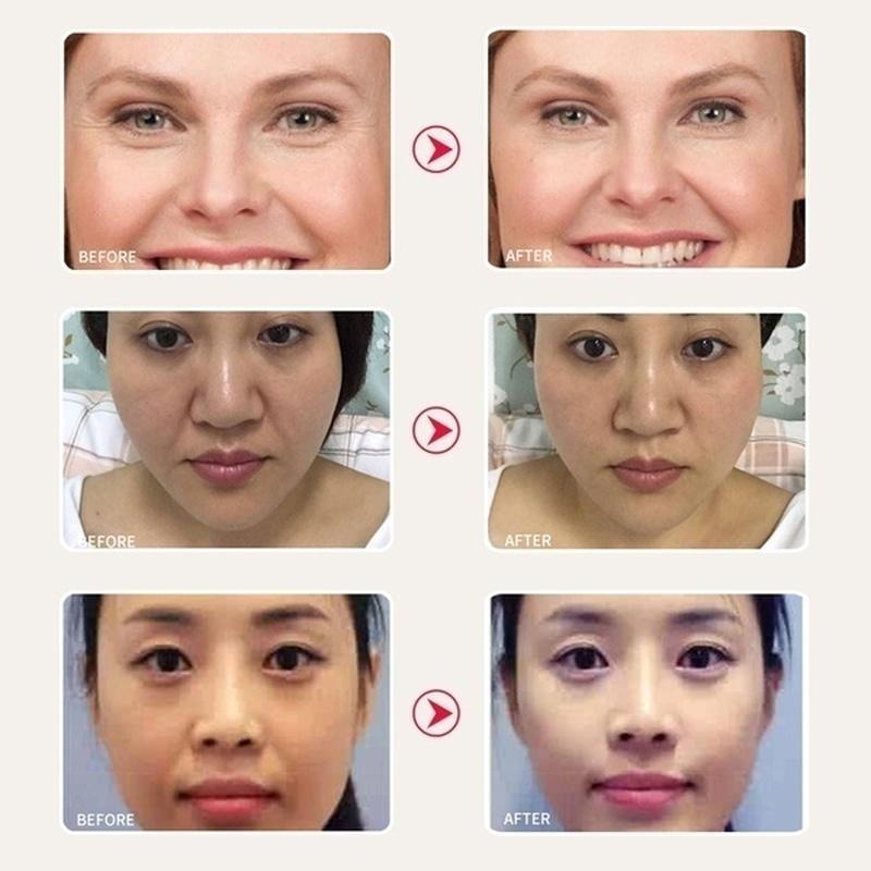 Увлажняющий крем для лица и области вокруг глаз удаляет темные круги под глазами Мешки под глазами Укрепляет против морщин