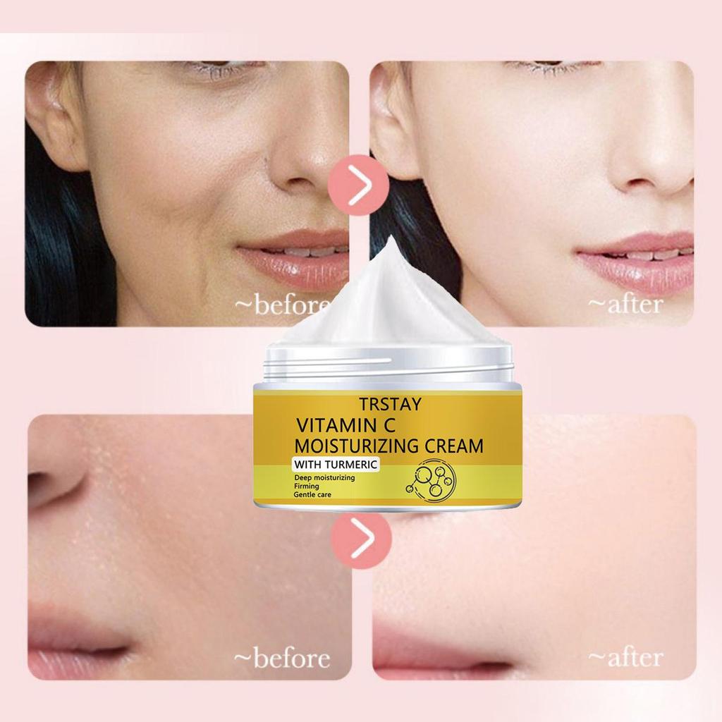 Осветляющий и полупрозрачный крем для кожи с пигментными пятнами, мягкое увлажнение без раздражения, уменьшает мелкие морщины, увлажняет кожу и улучшает состояние поврежденной кожи.