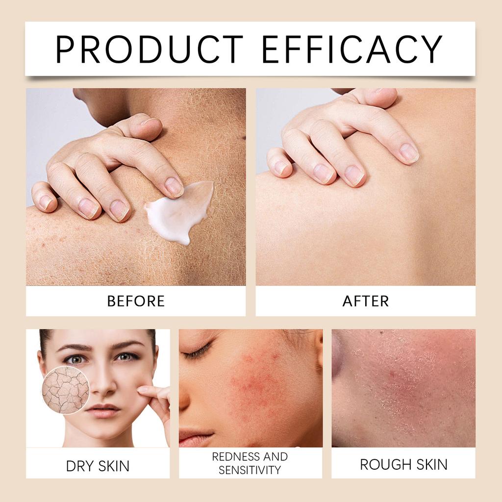 Многофункциональное увлажняющее средство для кожи глубоко увлажняет и удерживает влагу, обеспечивая увлажнение сухой, потрескавшейся, покрасневшей, чувствительной и комфортной кожи.