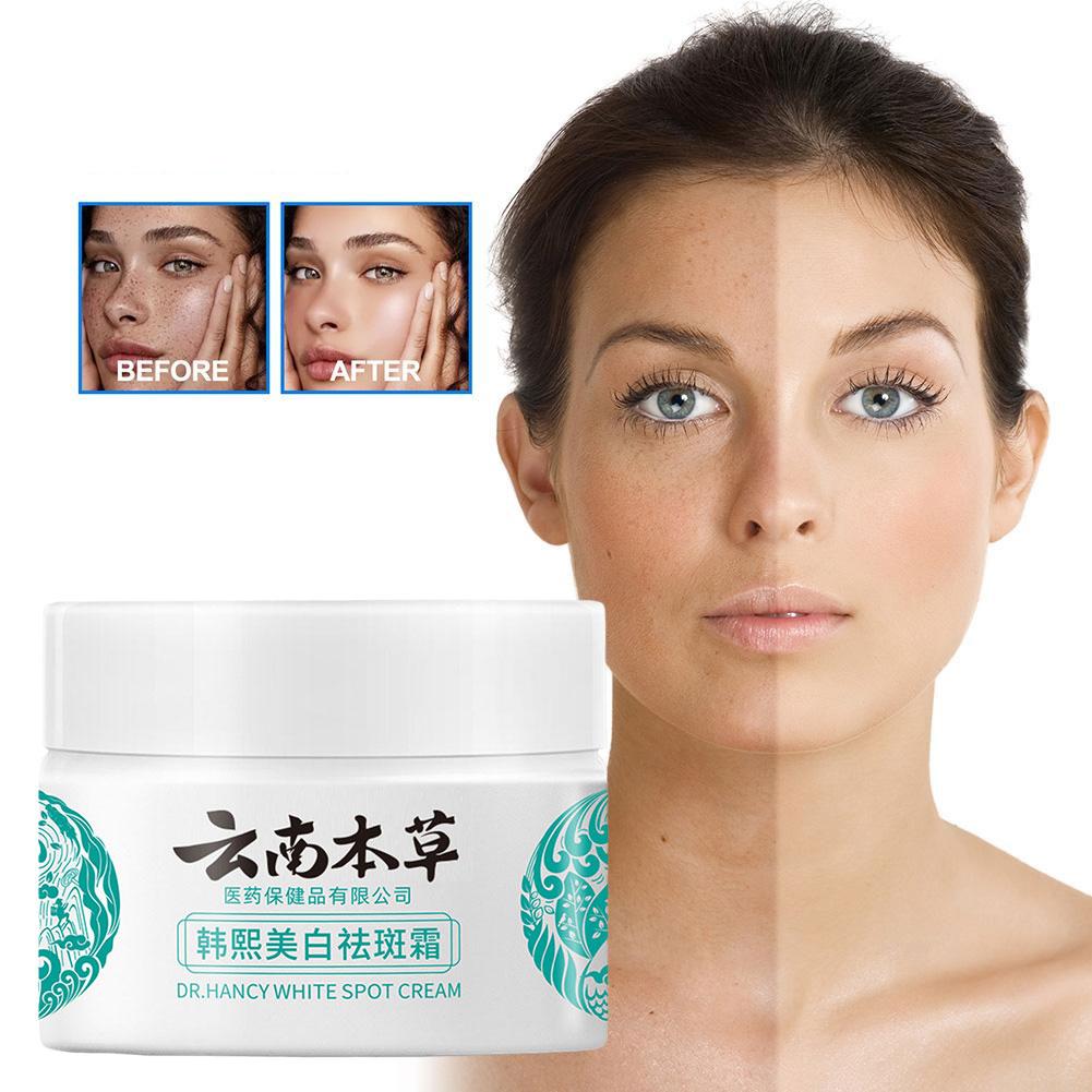 20g Powerful Yunnan Herb Whitening Freckle Cream Remove Face Moisturizing Care Face Dark Spots W8V5