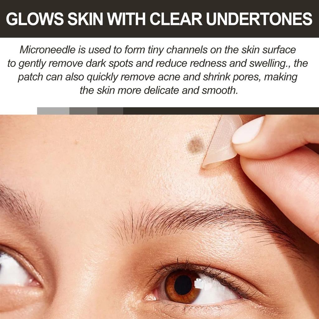 Патчи для лица от прыщей, микроиглы, сушильные патчи, закрывающие наклейки, 72 шт., уход, впитываются весь день
