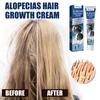 Крем Средства против выпадения волос Быстрорастущие Предотвращают сухость Пушистость Поврежденные Лечебное средство Уход за кожей головы Борода Мужчины Женщины 20 г