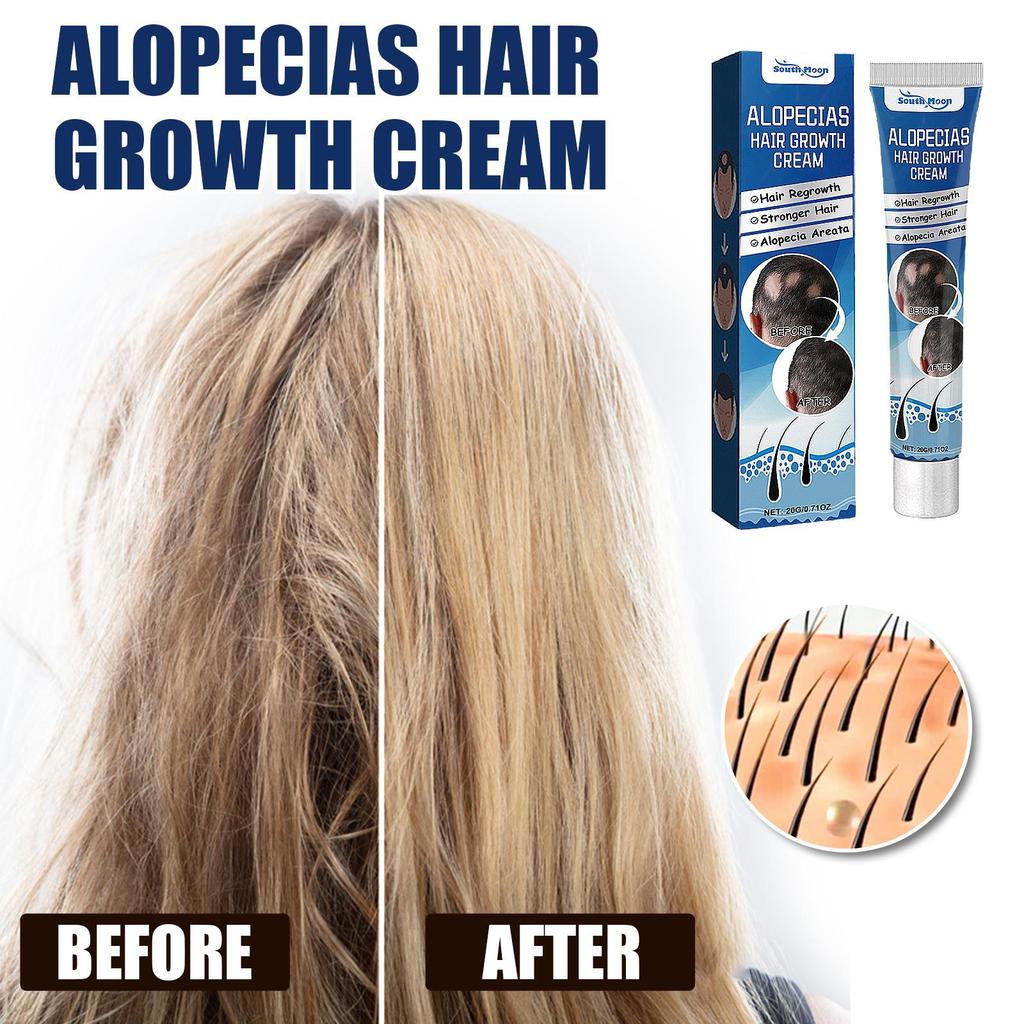 Крем Средства против выпадения волос Быстрорастущие Предотвращают сухость Пушистость Поврежденные Лечебное средство Уход за кожей головы Борода Мужчины Женщины 20 г