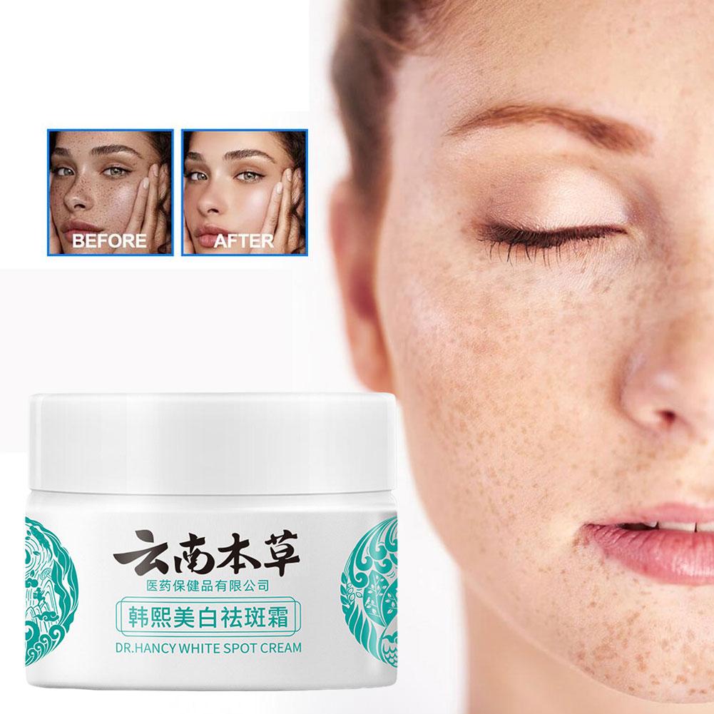 20g Powerful Yunnan Herb Whitening Freckle Cream Remove Face Moisturizing Care Face Dark Spots W8V5