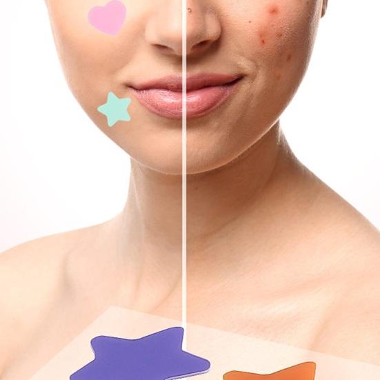 2 листа пластырей от прыщей, невидимые яркие цветные гидроколлоидные наклейки, пластыри от прыщей для ночного восстановления