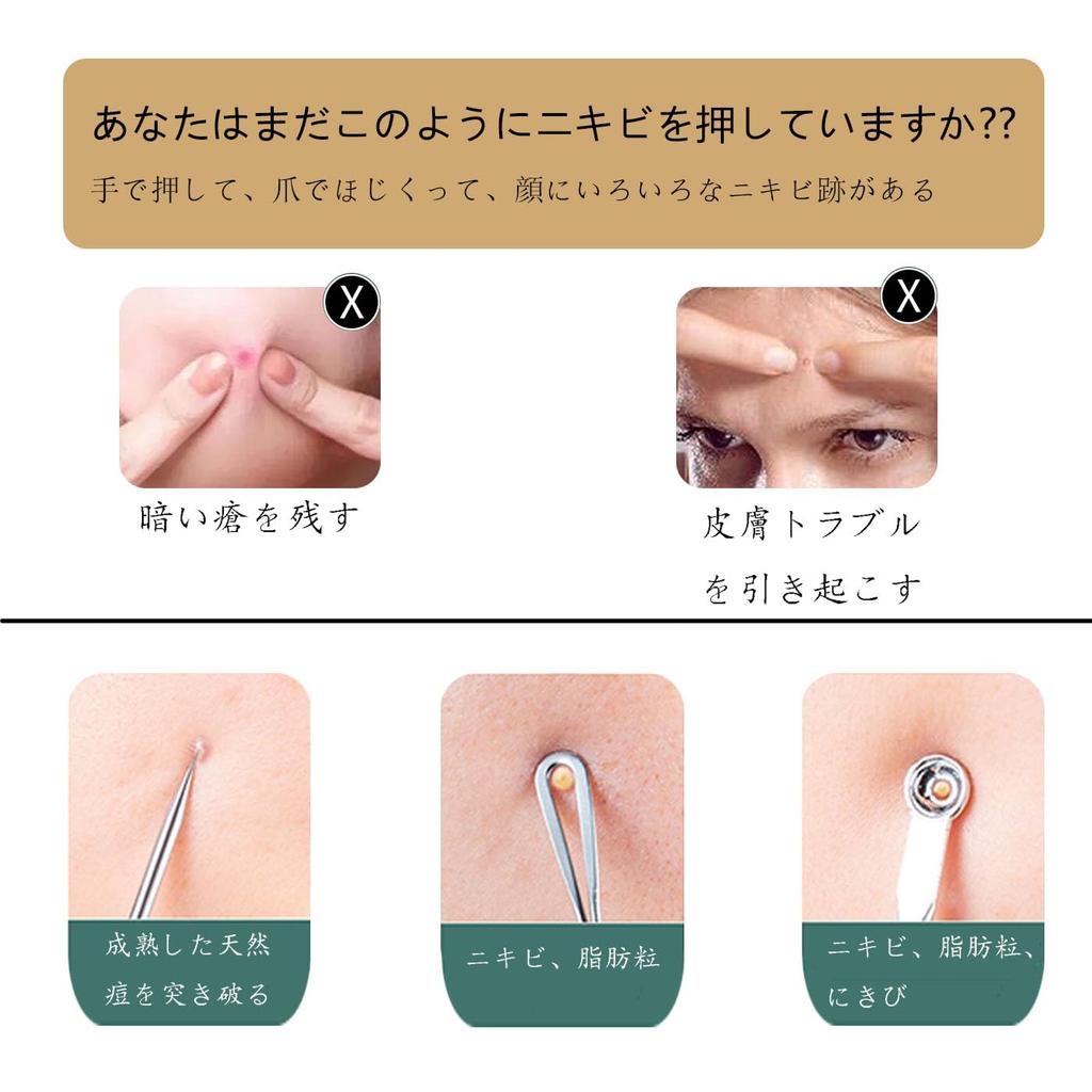 Игла от акне удаление черных точек нержавеющая сталь уход за порами красота набор набор, набор, сталь, набор, инструмент, принадлежности, 3 предмета