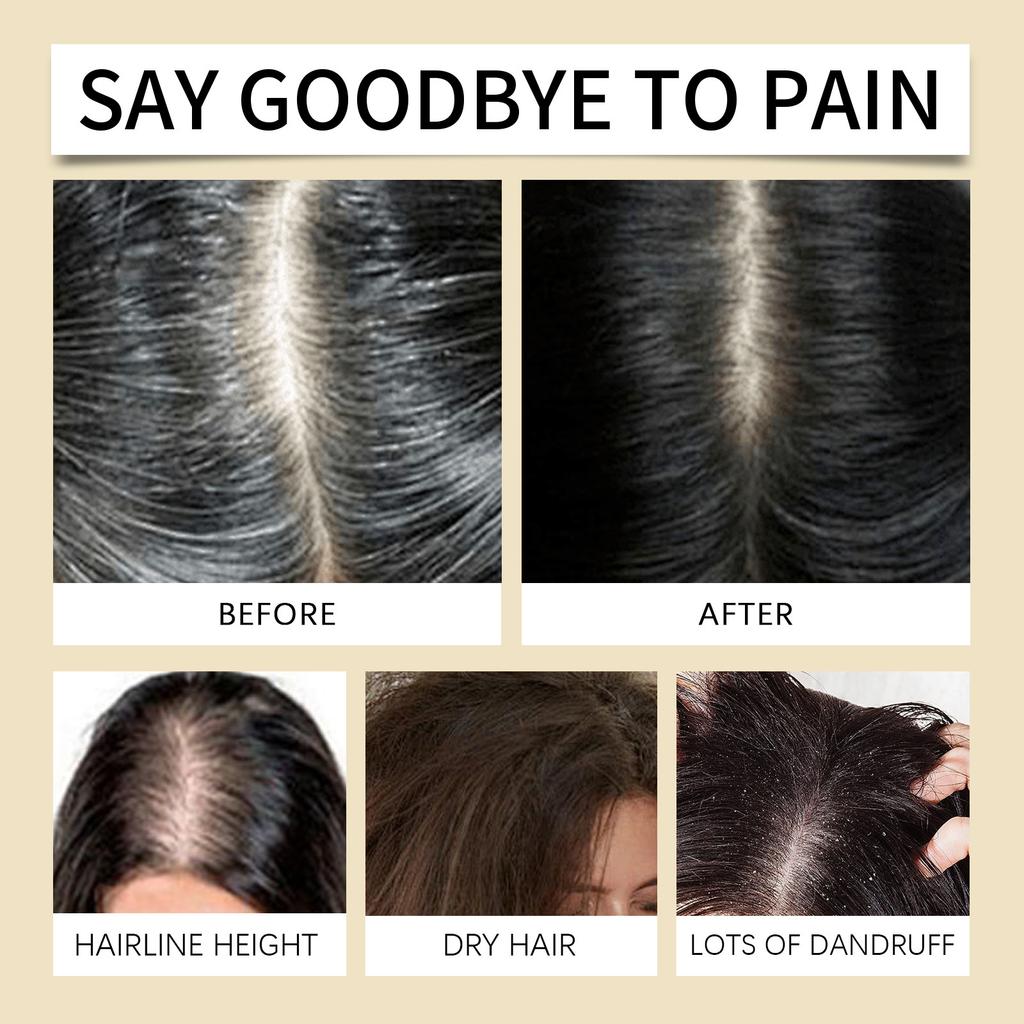 Растительное масло против выпадения волос увлажняет, защищает и укрепляет волосы, подходит для чувствительной кожи головы, 60 мл