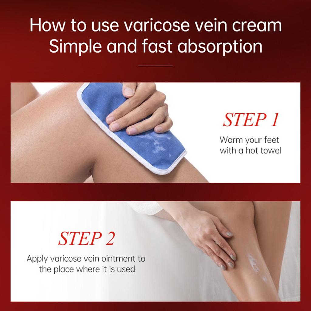 Паста для облегчения варикозного расширения вен Улучшение кровообращения Варикозное расширение вен Для усталых тяжелых ног Быстрое облегчение Новое