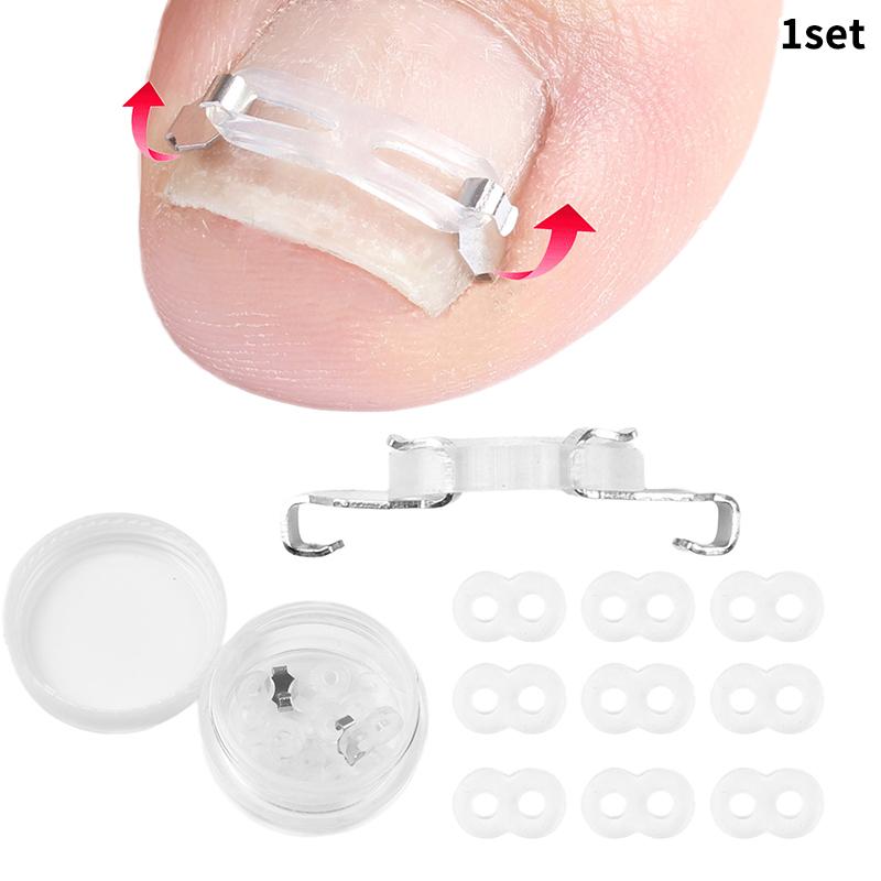 1/2 Набор Инструменты для коррекции вросшего ногтя педикюр восстановление лечение вросшего ногтя профессиональный инструмент для ухода за ногами