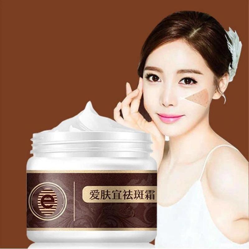 100% ORIGINAL Freckle Cream Anti-dark Spots and Brightening Skin Whitening Cream