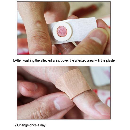 42 шт., безболезненный медицинский пластырь от мозолей, удаление мозолей, смягчение раздраженной кожи, уход за ногами