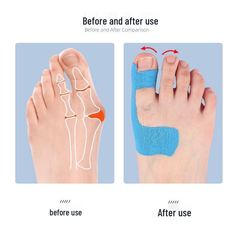 Elastic Toe Protector Anti-Friction Kinesiology Tape for Bunion Support