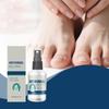 Nail Spray, Fungal Spray, Deep And Natural Ingredients, Nail Spray Fungal Nails Spray; Nails Liquid,30ml