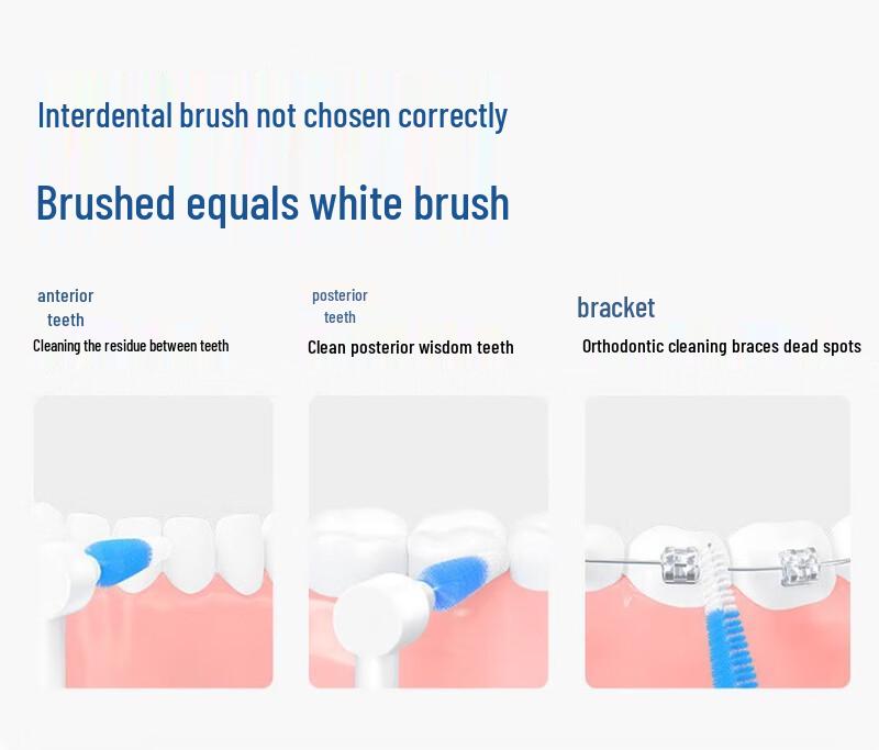 FAWNMUM L-shaped 1.0mm Interdental Brushes