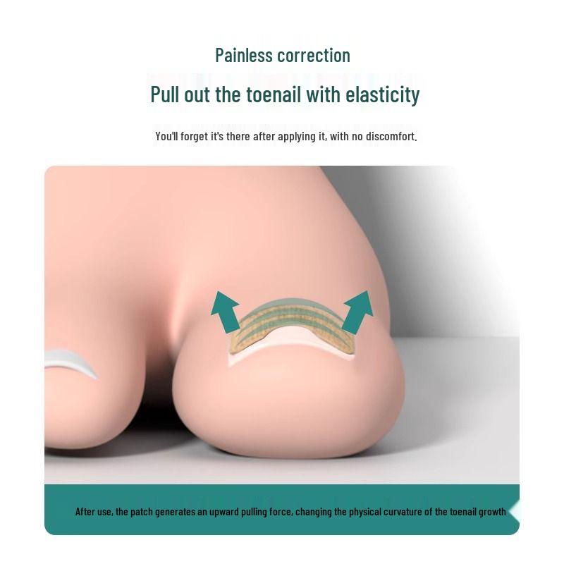 Самоклеящиеся накладные наклейки для ногтей на ногах для ремонта и коррекции вросших ногтей